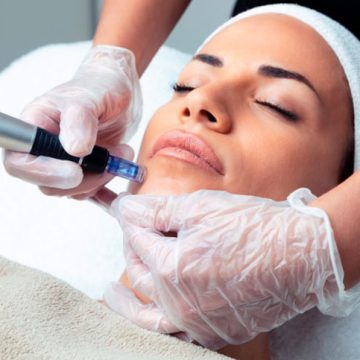 Dermapen Facial (Mesoterapia con lápiz dérmico)