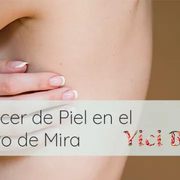 El Poder del Conocimiento: ¡Cáncer de Piel en el Punto de Mira en el Mes Internacional de Concienciación!