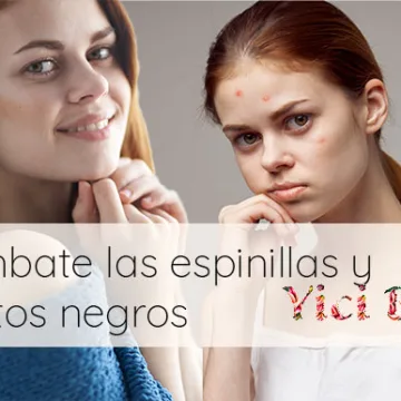 Revolucionando el cuidado de la piel: combate espinillas y puntos negros con Yici Skin